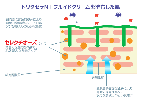 セレクチオーズメカニズム
