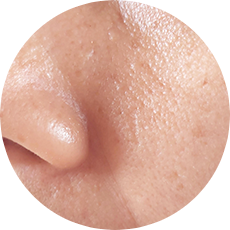 皮脂・テカりに悩むすべての方