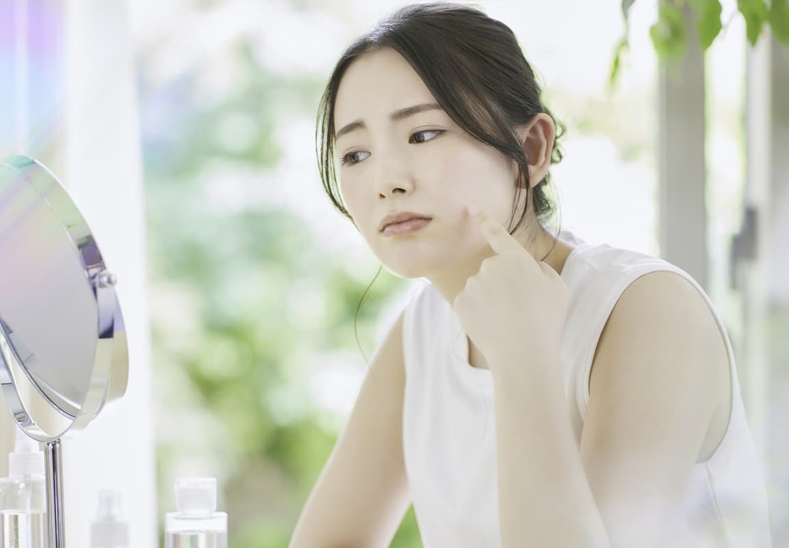 ニキビ・吹き出物